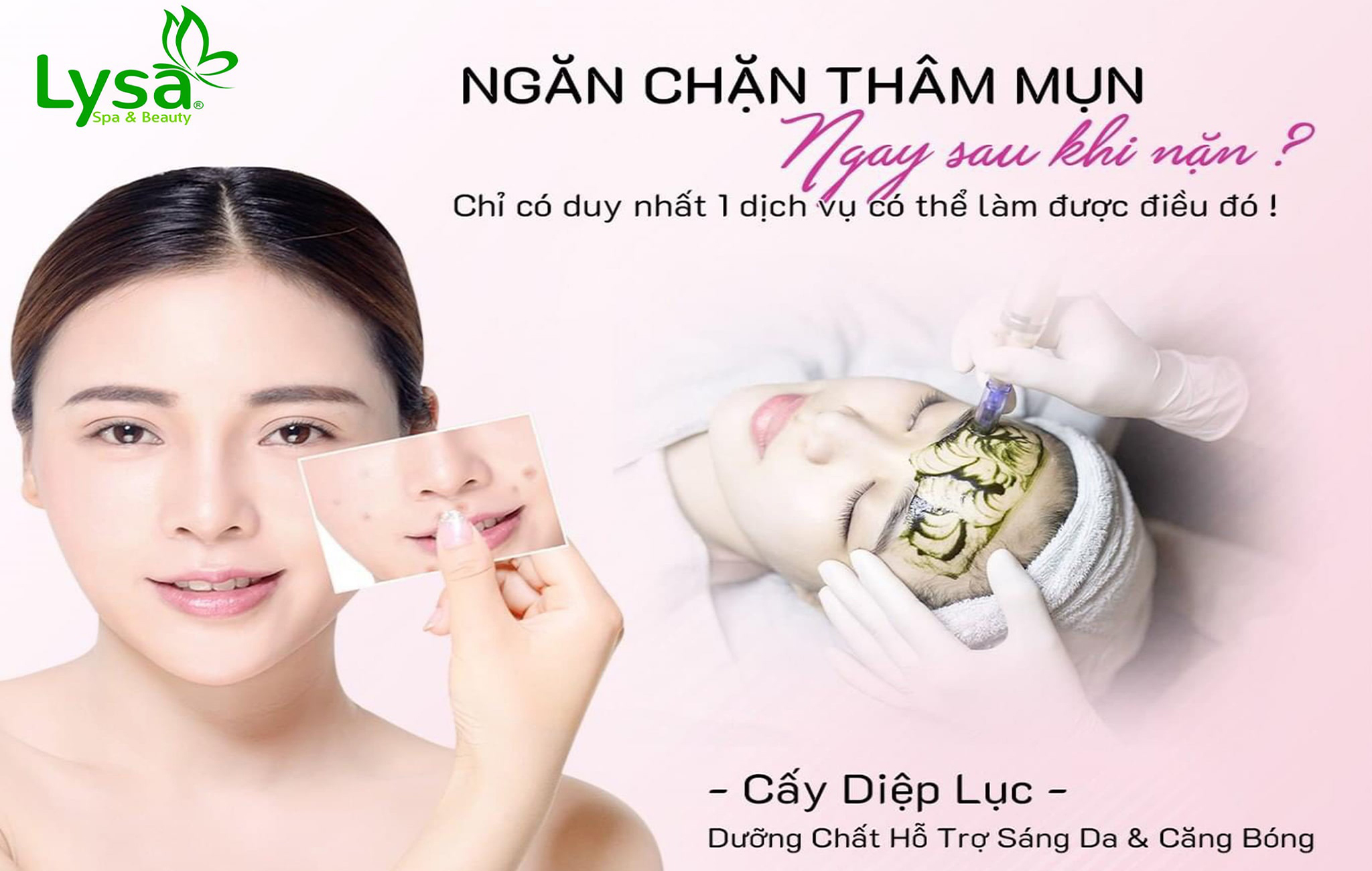 Phục Hồi Làn Da Nhờ Nặn Mụn Trị Thâm Cấy Diệp Lục